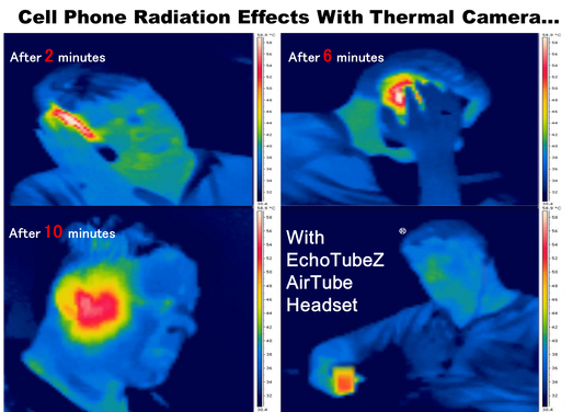 Cell phone and cordless phone use causes brain cancer: New review